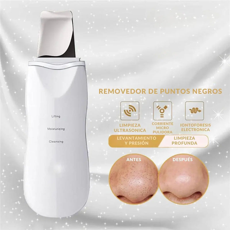 FreshSkin - Limpiador Peeling Facial Ultrasónico