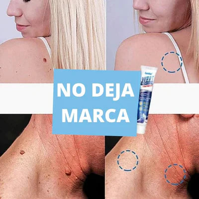 WartFree - Crema Eliminadora de Verrugas